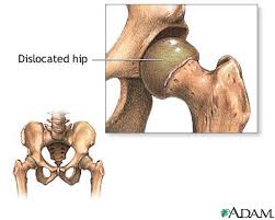 Although most  dislocations  are