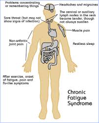 Diagram of  Chronic Fatigue 