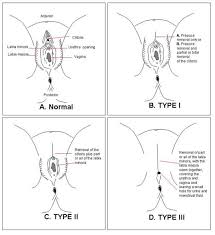 If diagrams of     female genitals     with            