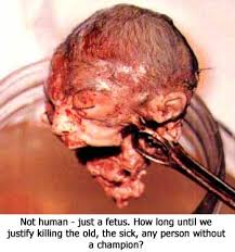 abortion -funds