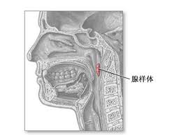 北京咽科专家讲述腺样体肥大的症