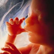  Abortion  is
