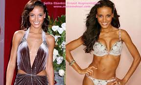 Image Did <b>Selita Ebanks</b> Have Plastic <b>...</b> Picture