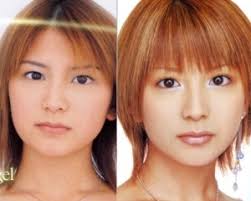 矢口真里 整形か？