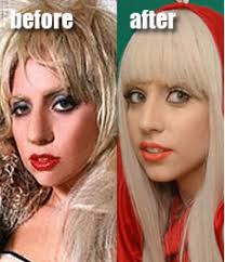 Lady GaGa Nose Job: Yes or No?