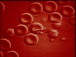Malaria Vaccine - via Daymix