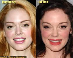 Cosmetic surgery operations - via Daymix