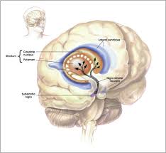 in Parkinson's Disease - via Daymix