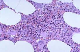 of the cells in the bone marrow