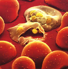 Malaria - via Daymix