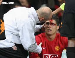 Image <b>Cristiano Ronaldo</b> suffered Picture