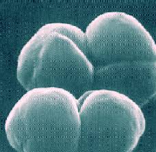   Archaebacteria   Example