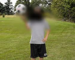  macular degeneration  sees