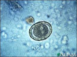 http://www.nlm.nih.gov/medlineplus/ency/images/ency/fullsize/1005.jpg