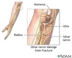 The nerve is commonly injured - via Daymix