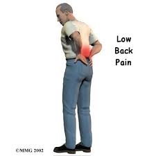 First Time with  Low Back Pain ?