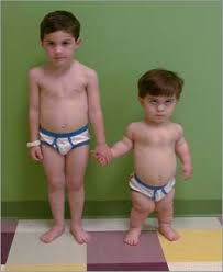 http://peterswordoftheday.files.wordpress.com/2008/09/achondroplasia-1.jpg