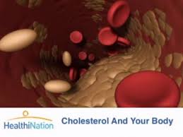  Cholesterol  Information