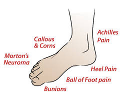 achilles  pain , ball of  foot 