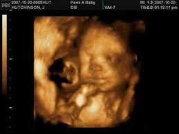 Cali's 4D Ultrasound 26 Weeks