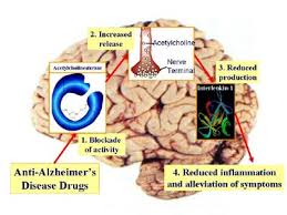 Memory disorders clinic