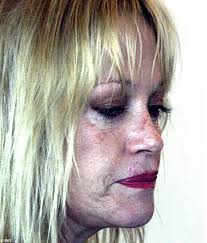 Image What the hell happened to <b>Melanie</b>? Picture