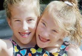   Abigail   and  Brittany Hensel  