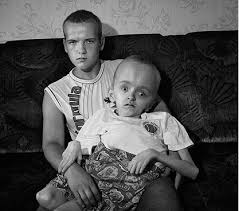 Some parts of the  Chernobyl   region    