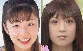 Yahoo!ブログ - ガーゾー新聞