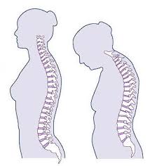 consequences on posture. - via Daymix