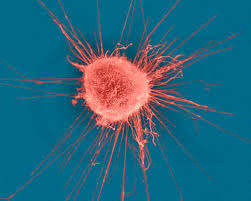 cancer cell, breast.jpg