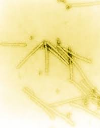 Tobacco Mosaic Virus Magnified - via Daymix