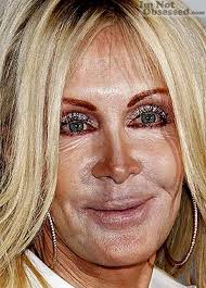 What Happened To Joan Van Ark