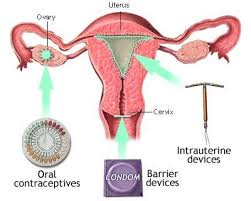  Birth Control  for Middle