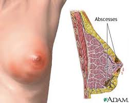 http://www.mdconsult.com/das/patient/body/0/0/10041/17028_en.jpg