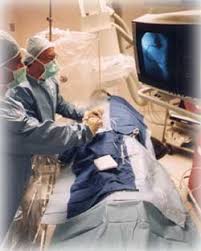  Angioplasty 