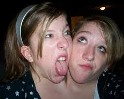 Two Headed Twins 10