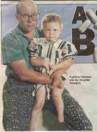 His claim that thalidomide is - via Daymix