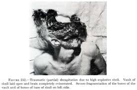 Traumatic decapitation - via Daymix