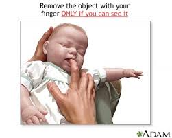 aid -  infant under 1 year 