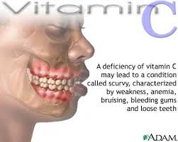 Vitamin C Picture 3
