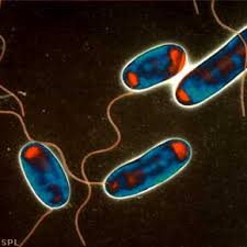 Legionellosis