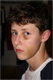 The Situation of Bullying - via Daymix