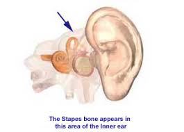 http://www.netwellness.org/healthtopics/ent/3D2-110p.jpg