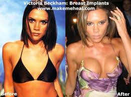 Victoria Beckham Finally