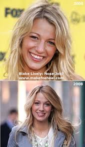 Blake Lively