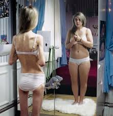 Tags: Anorexia, Ruzanna