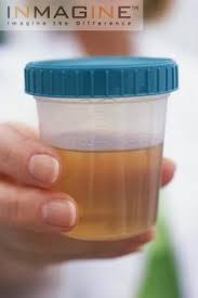the urine - via Daymix