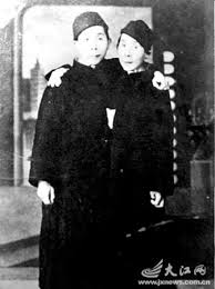 兄弟连体70年各自娶妻生子一人饮
