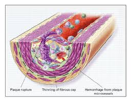 cholesterol starts off by
